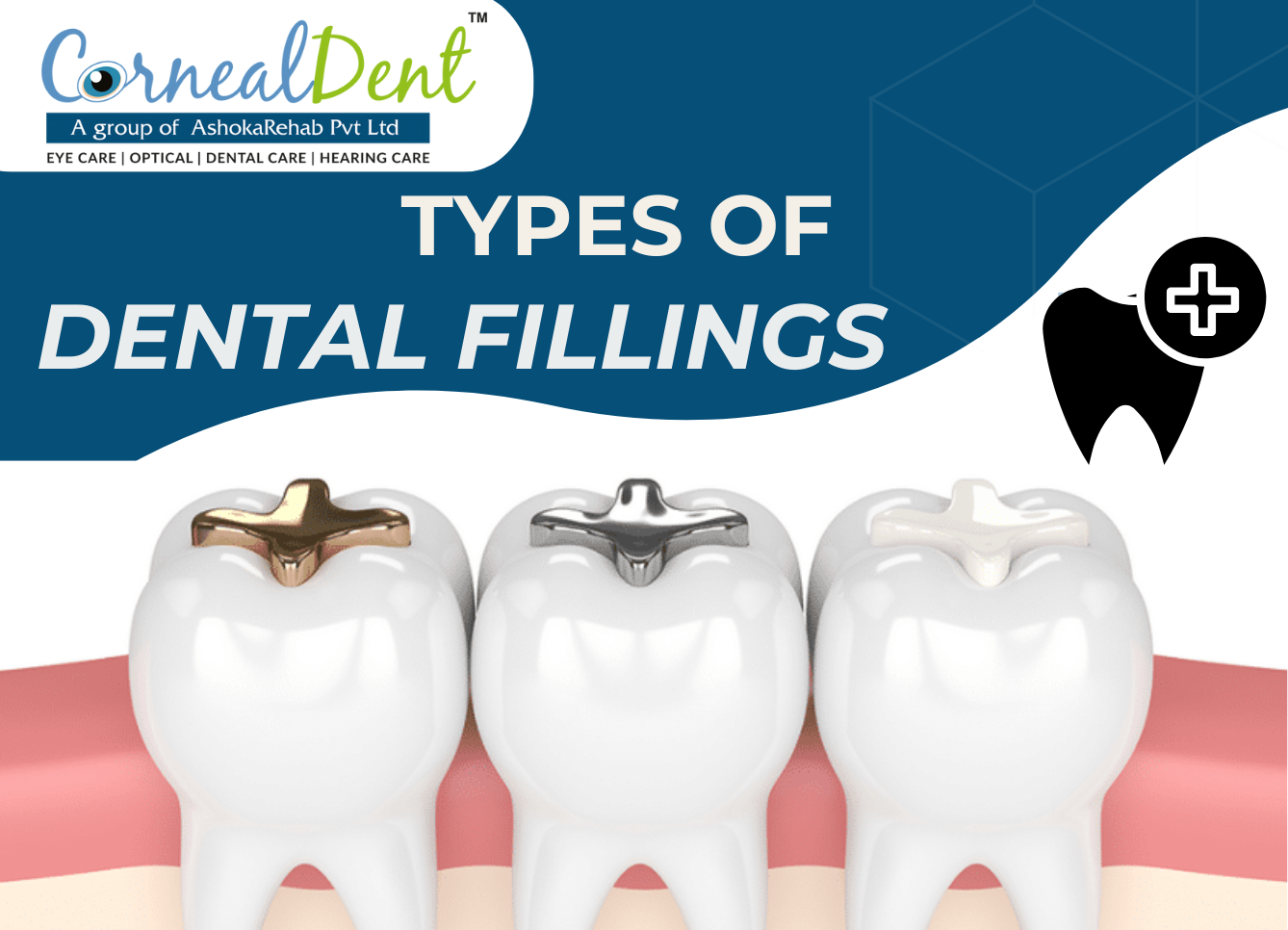 types of dental fillings