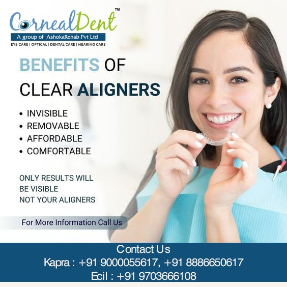 benefits of clear aligners