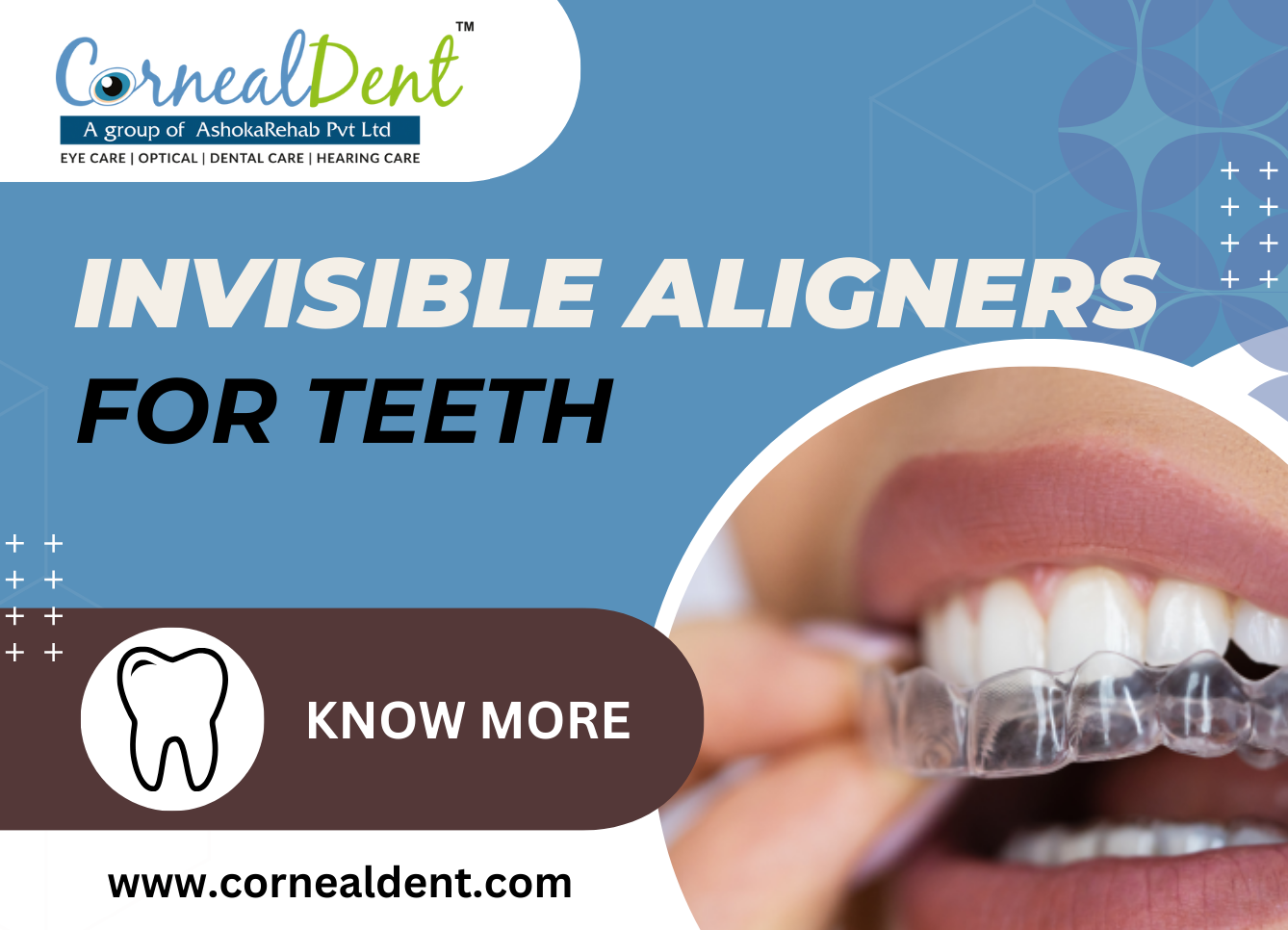 cornealdent's posture showing invisible aligners for teeth