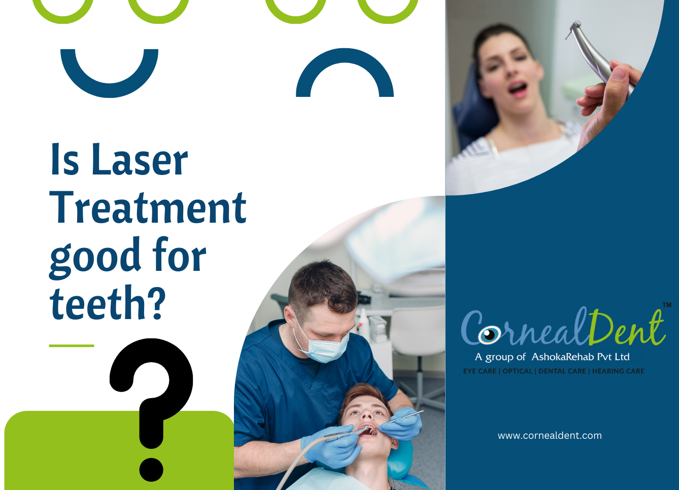 Is Laser Treatment Good for Teeth?