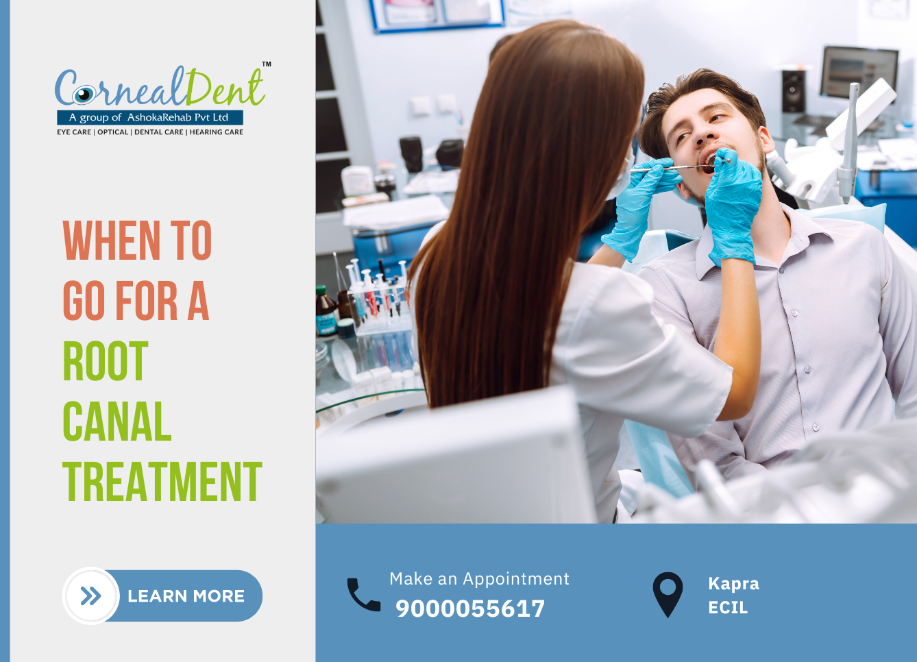 When to Go for a Root Canal Treatment?