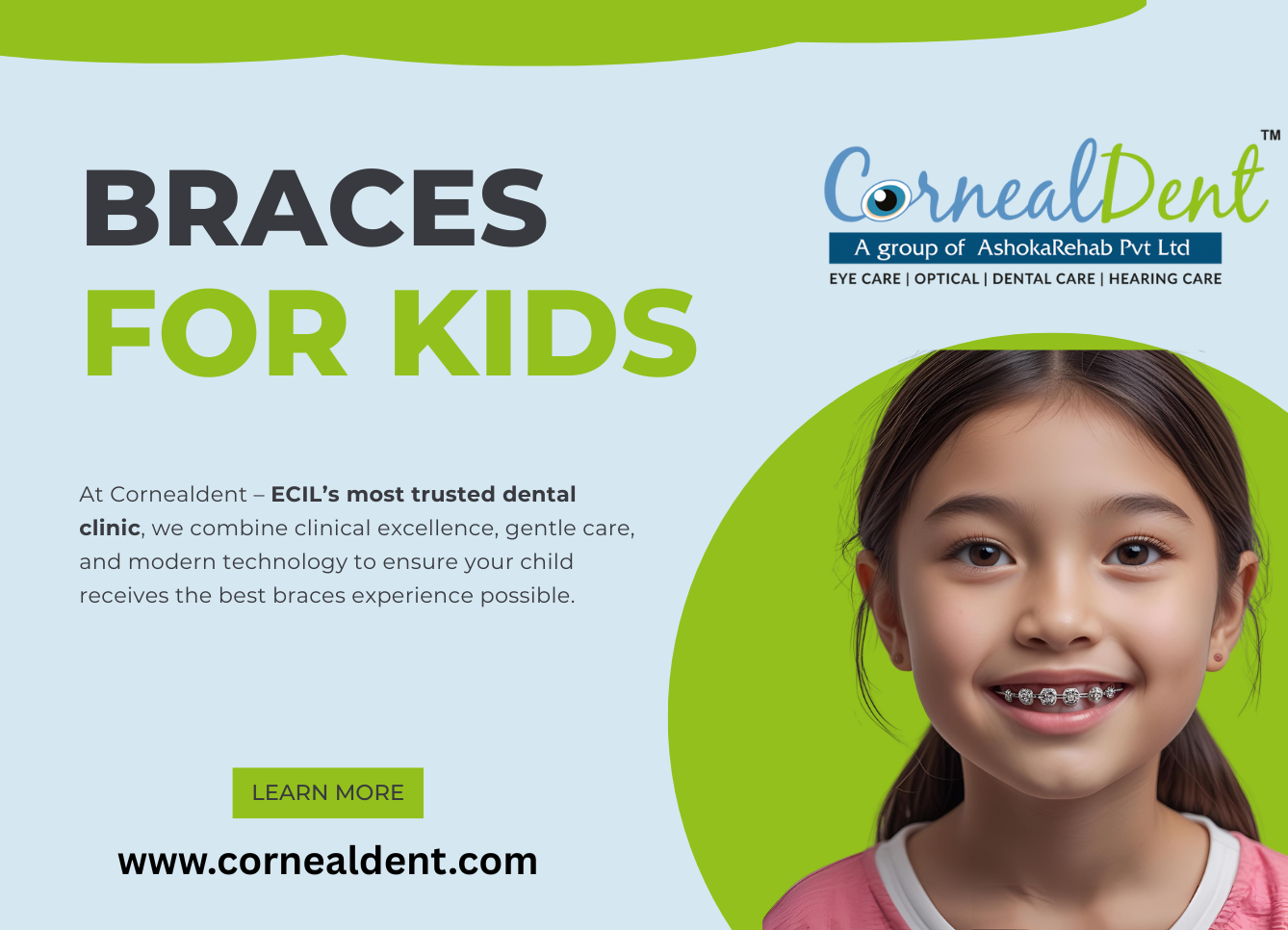 Braces For Kids